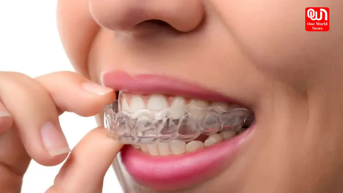 Aligners